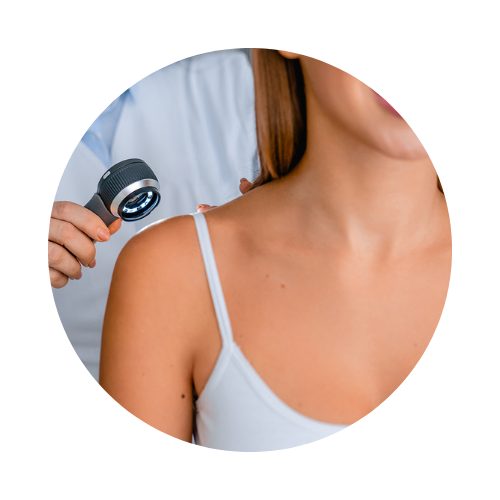 Visite Specialistiche - Dermatologia