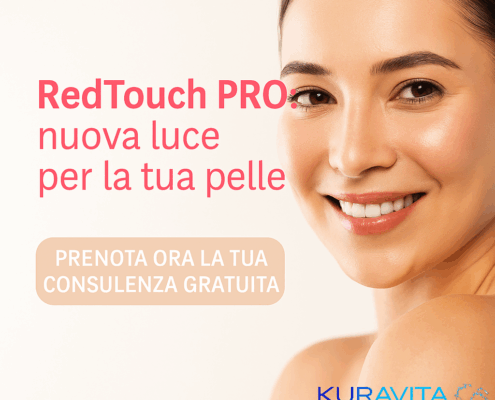 laser rughe macchie melasma