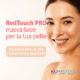 laser rughe macchie melasma