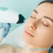 laser q switch rimini