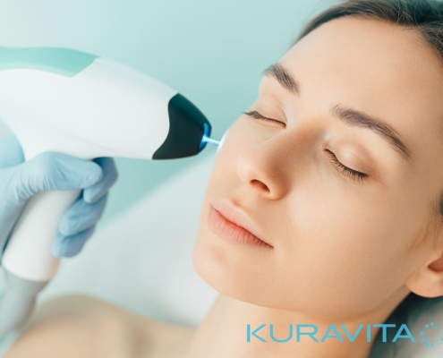 laser q switch rimini