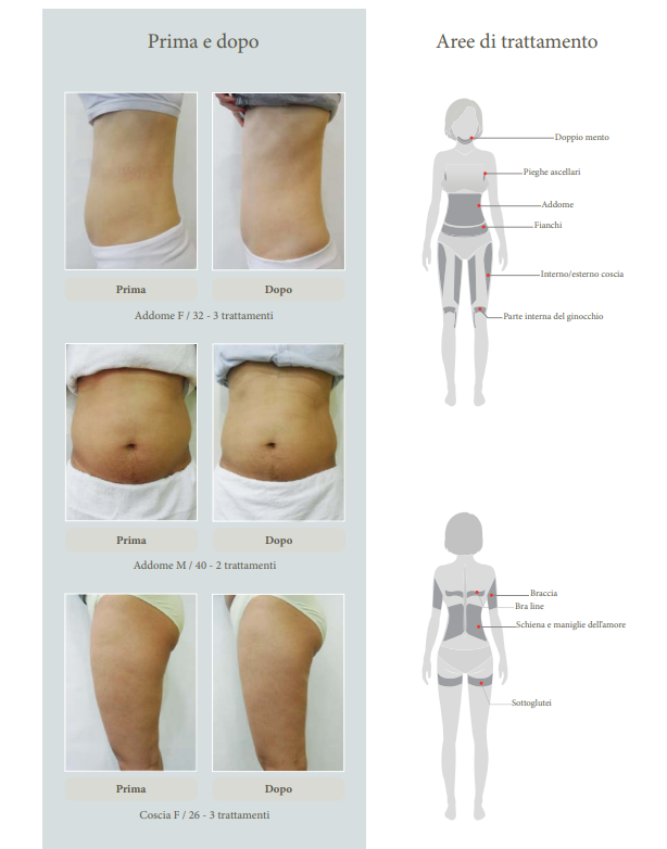 coolshaping prima e dopo