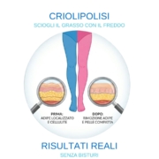 criolipolisi cellulite rimini