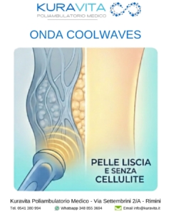 Onda Coolwaves Rimini: Pelle Liscia e Senza Cellulite