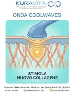 Onda Coolwaves Rimini: Produzione Nuovo Collagene